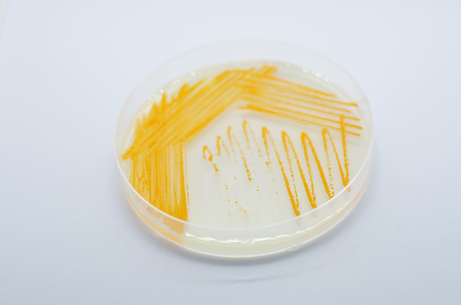 Urocultivo de Orina en una placa Petri